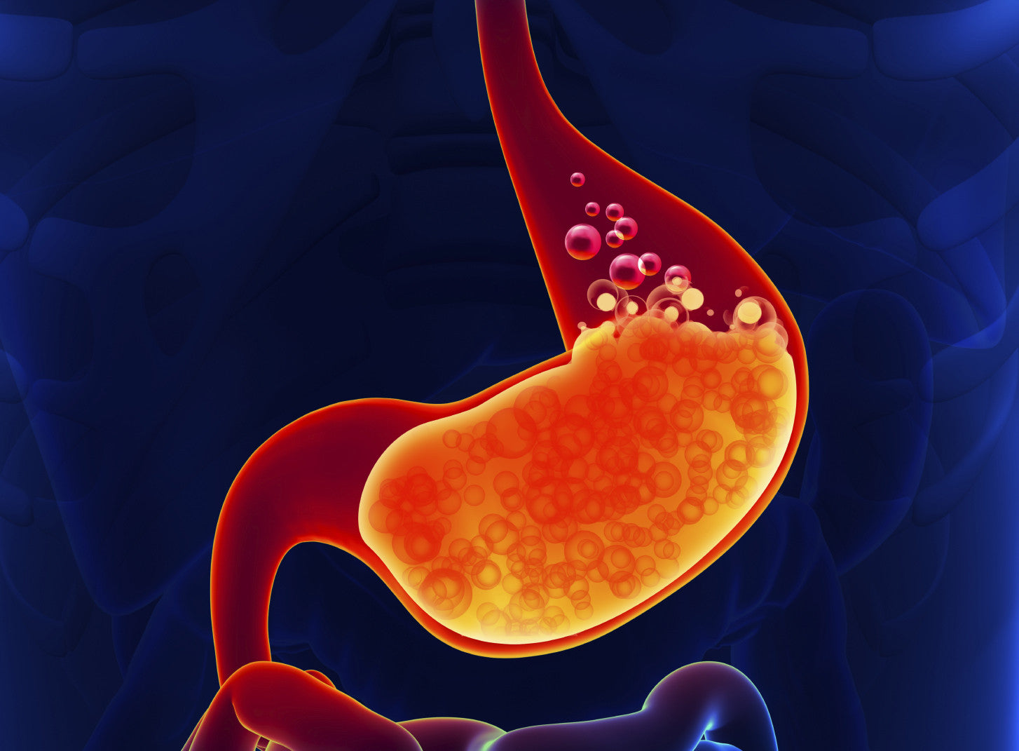 Heartburn shown in a humans body using a thermal map