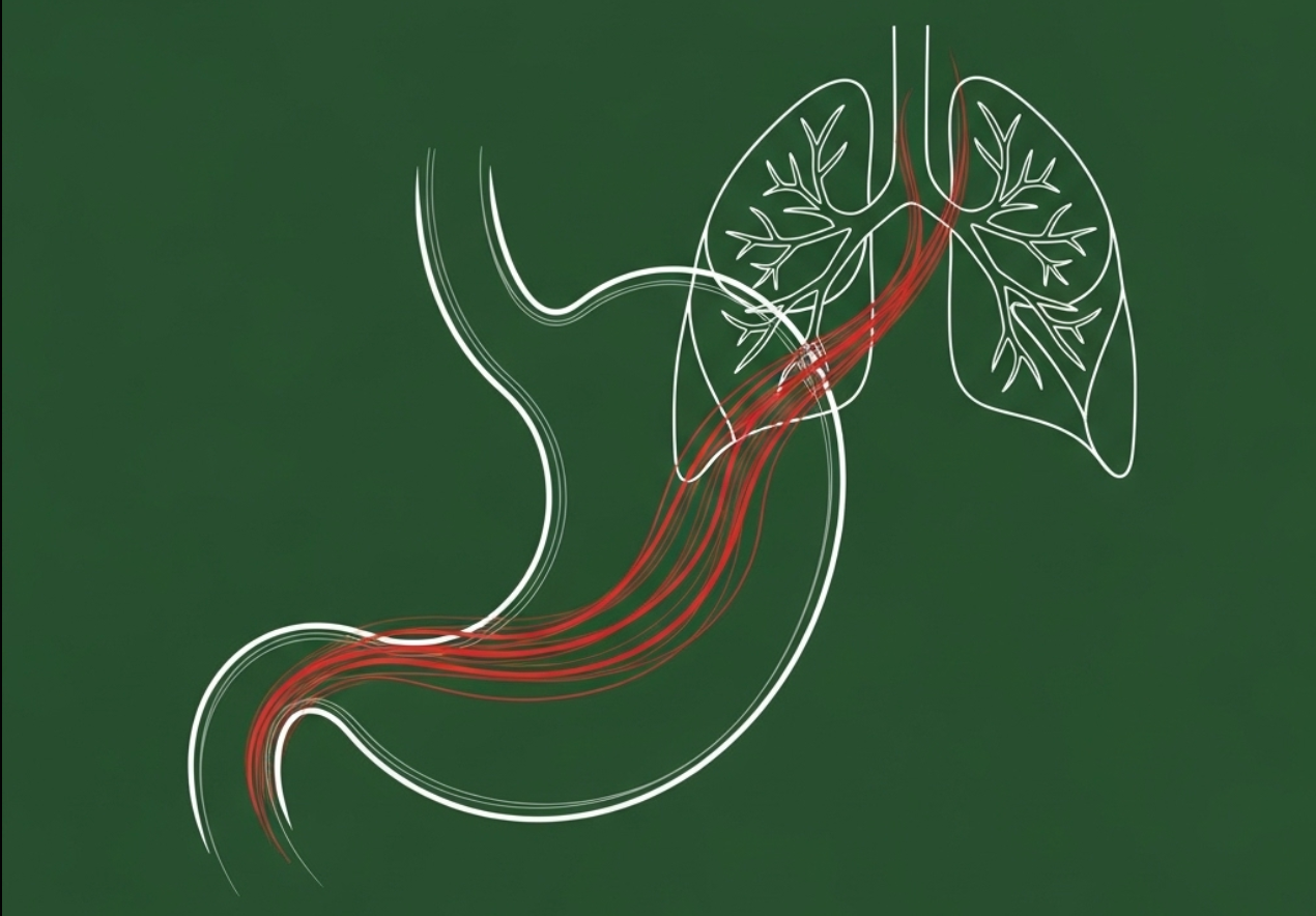 Illustration showing acid reflux from the stomach reaching the lungs, highlighting the connection between GERD and asthma symptoms.
